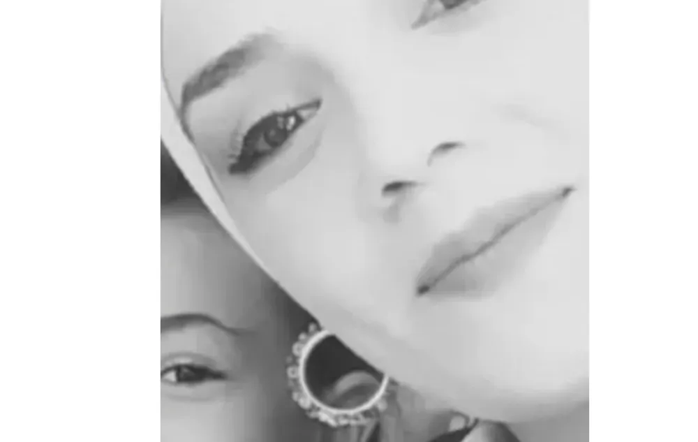 Kazada ağır yaralanan Zeynep Demirbaş hayatını kaybetti   