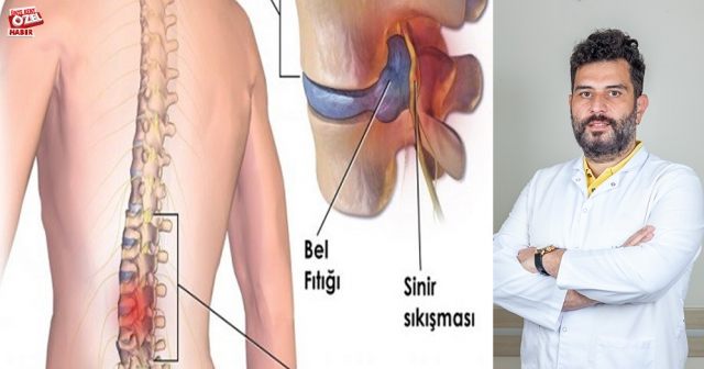 Her bel ağrısı fıtık mıdır?